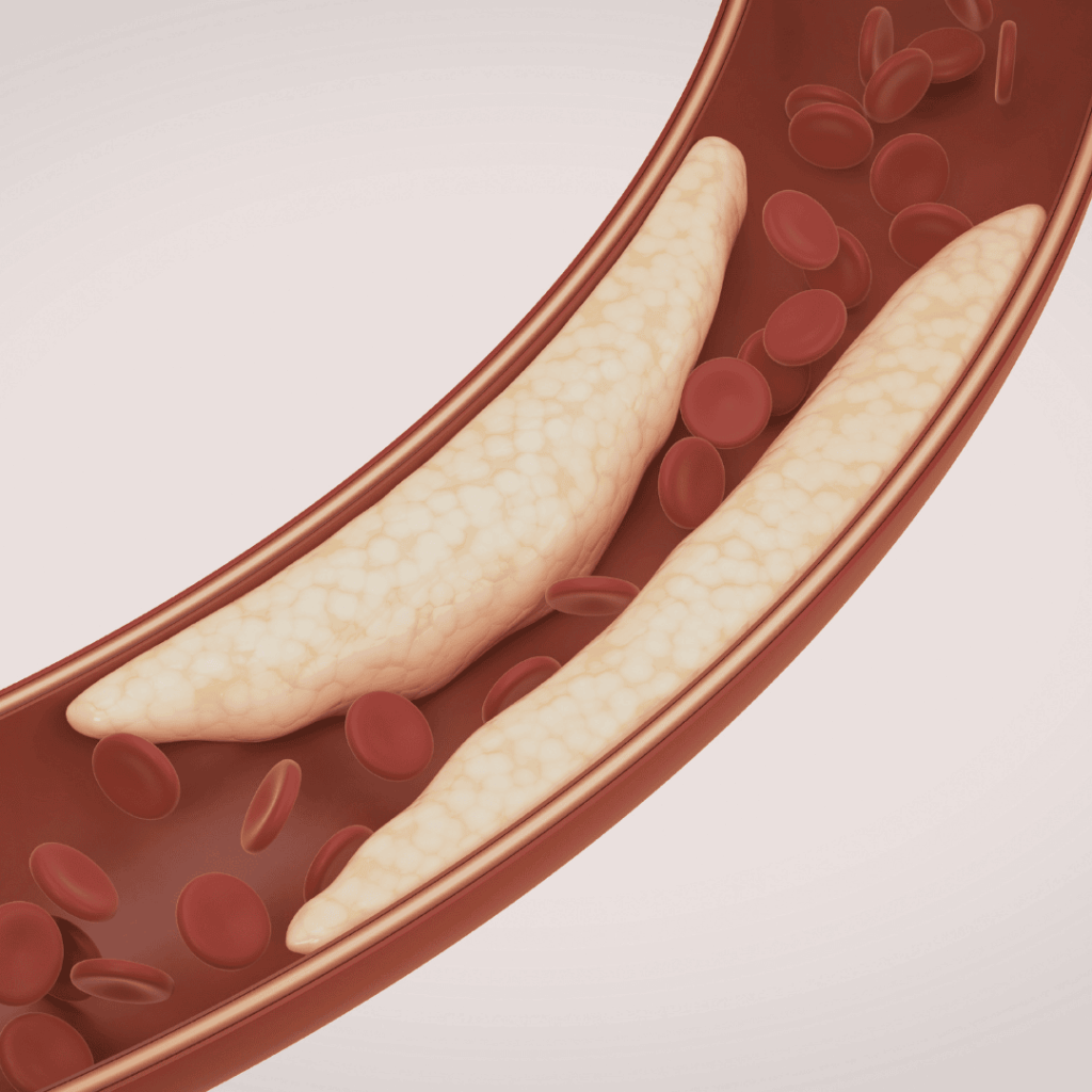 反式脂肪是什麼？
